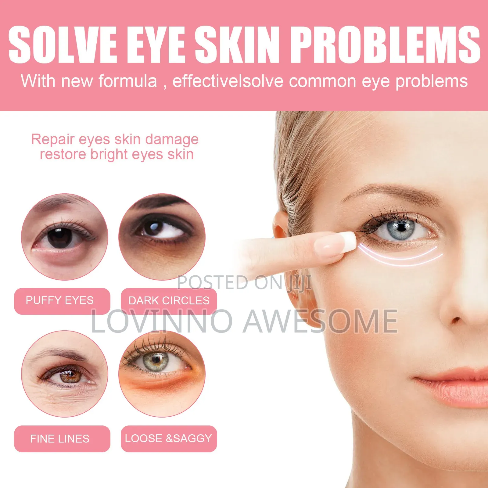 West Month Probiotic Skincare–Diminishing Rose Hip Eye Balm