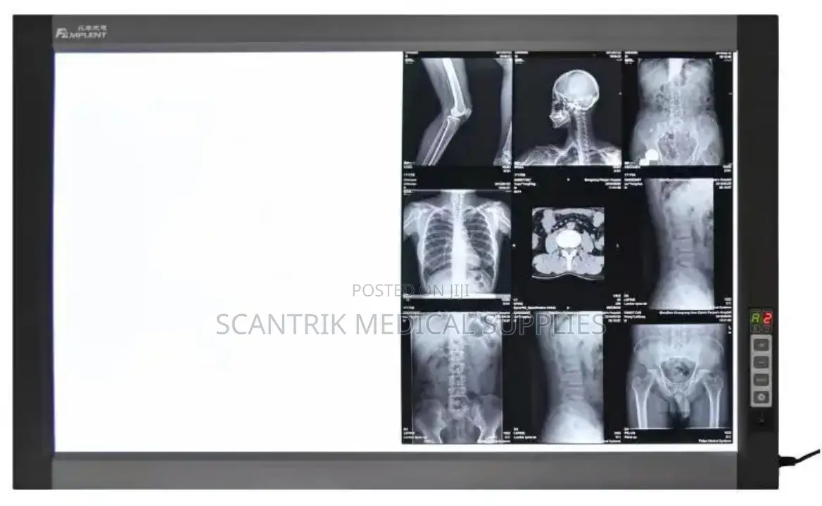 X-Ray Light Screen