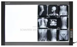 X-Ray Light Screen