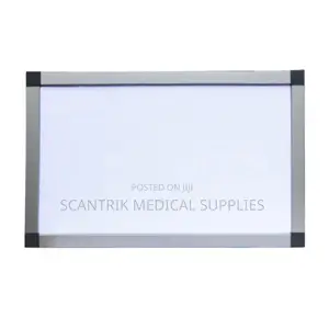 High Brightness Led X-Ray Film Viewer Box