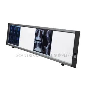 X-Ray Medical Film View