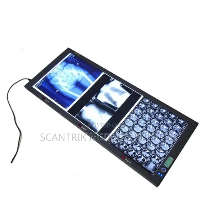 Led X-Ray Viewer