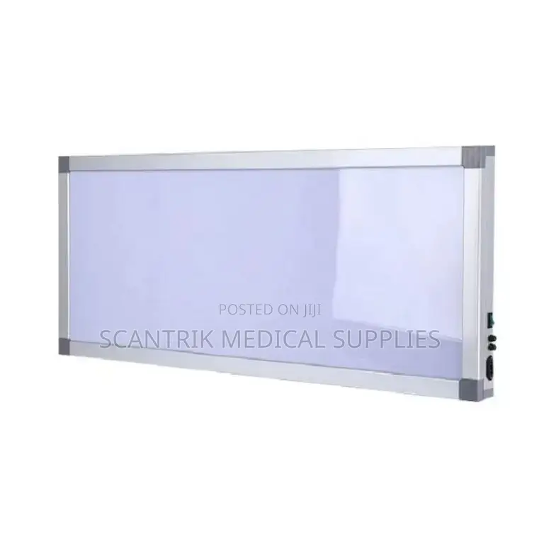 Dimmable X-Ray Viewer