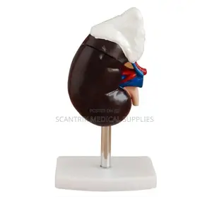 Kidney Model for Medical Student