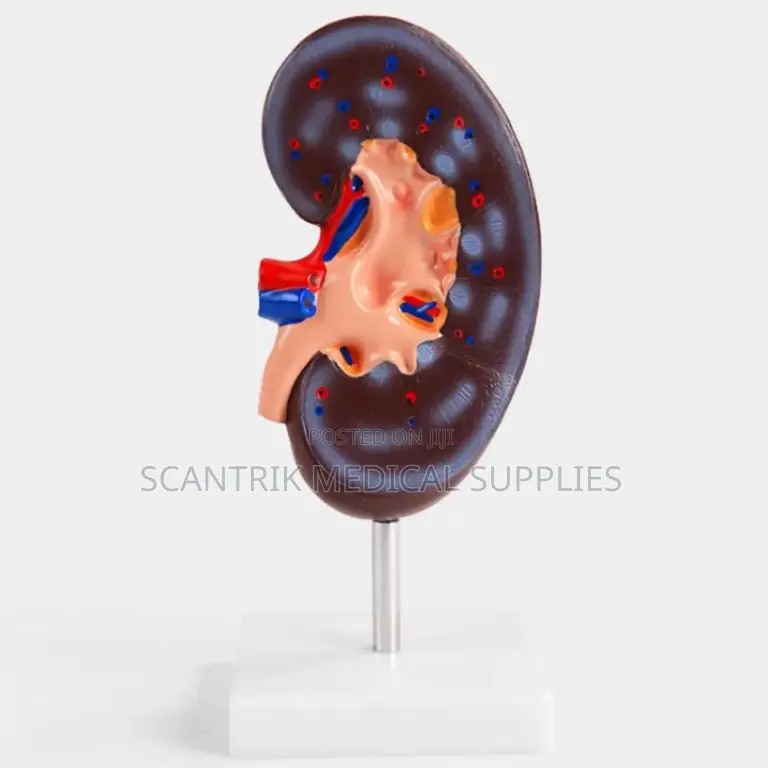 Medical Anatomical Model