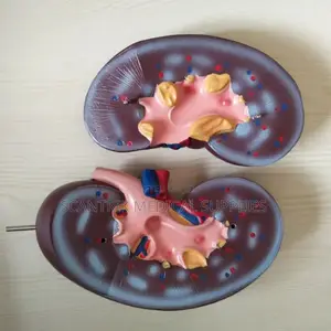 Human Plastic Kidney