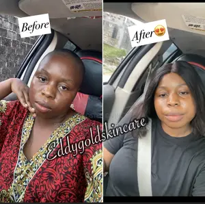 Super Whitening Face Cream