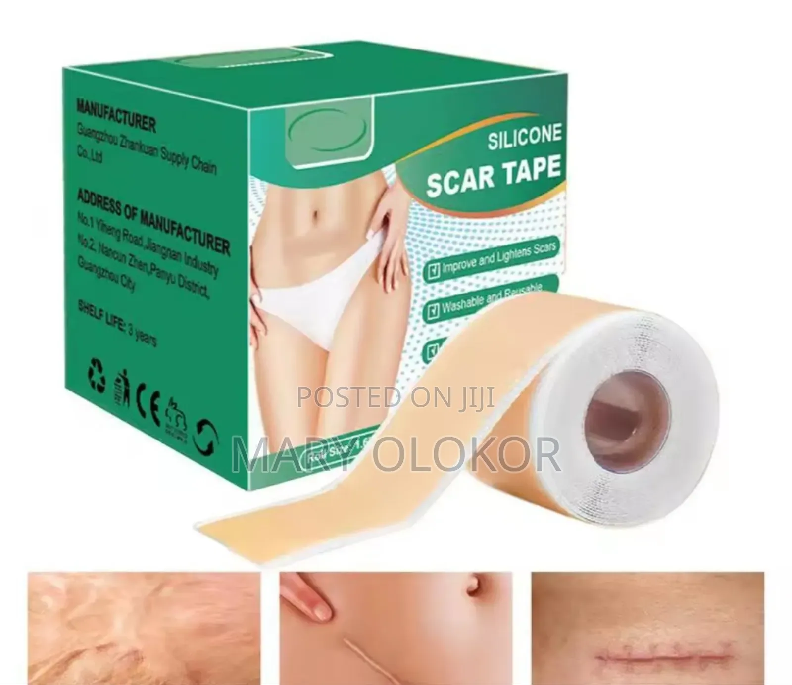Silicon Scar Sheet Removal