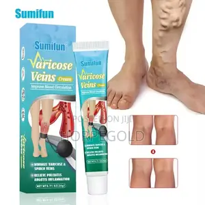 Vericose Veins Cream