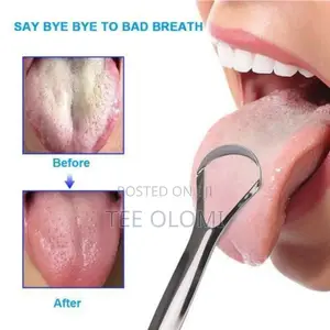Metal Tongue Scraper - Set Of 2