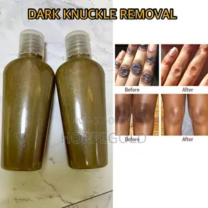 Dark Knuckle Removal