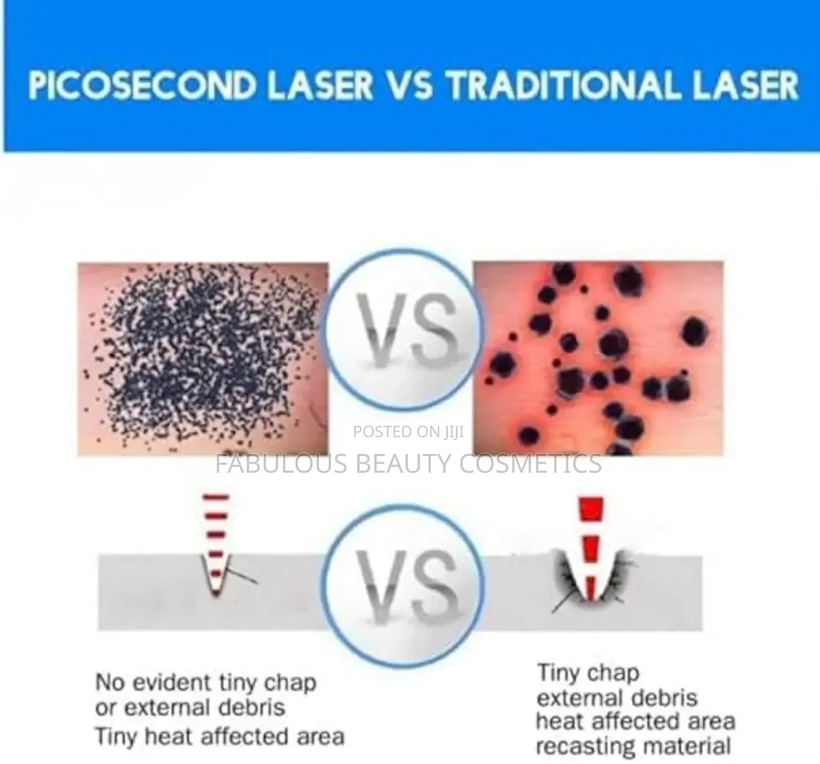Picosecond Laser Pen Light Therapy Tattoo Scar Mole Removal