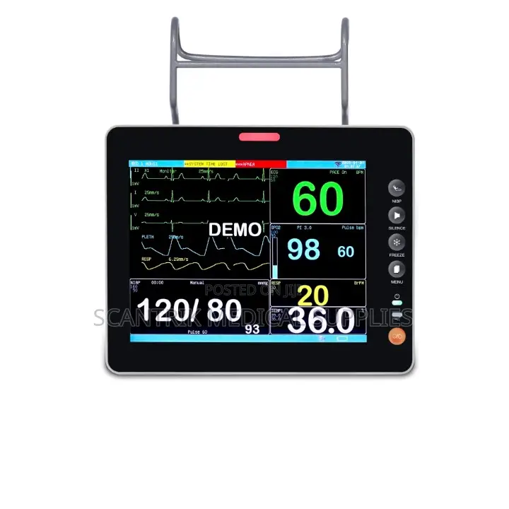 Continuous Monitoring System