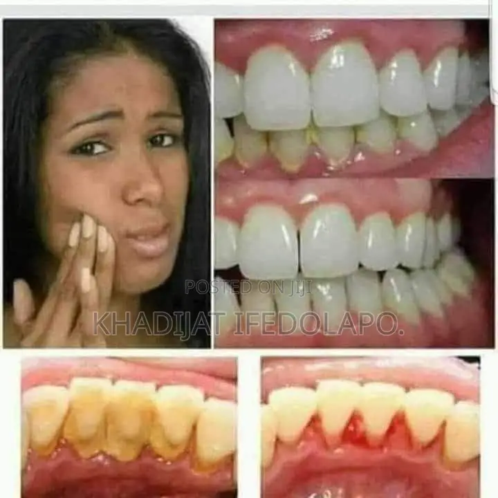 Optifresh Toothpaste