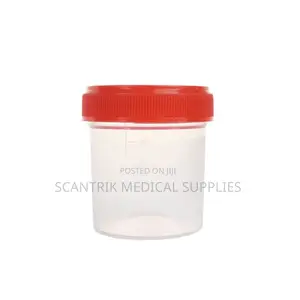 Labeled Urine Specimen Cup