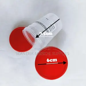 Tagged Urine Container
