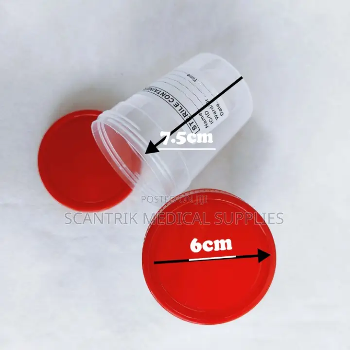 Tagged Urine Container