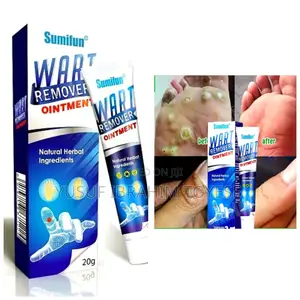 Natural and Fast Acting Skin Tag Removal