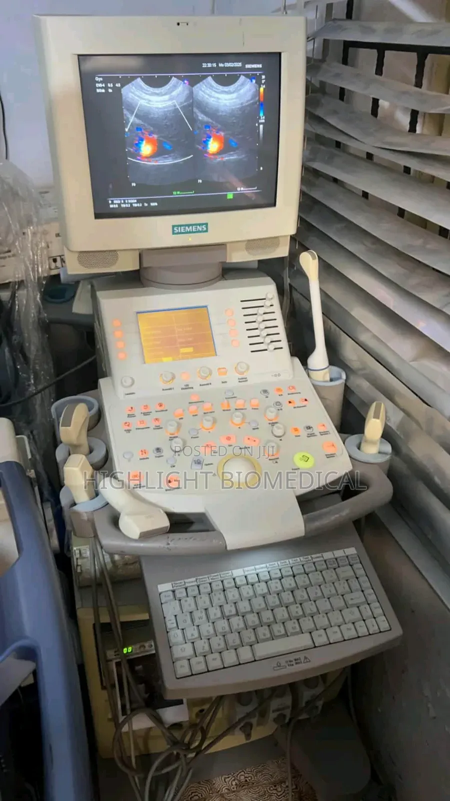 Sonoline G60s With Three Probes