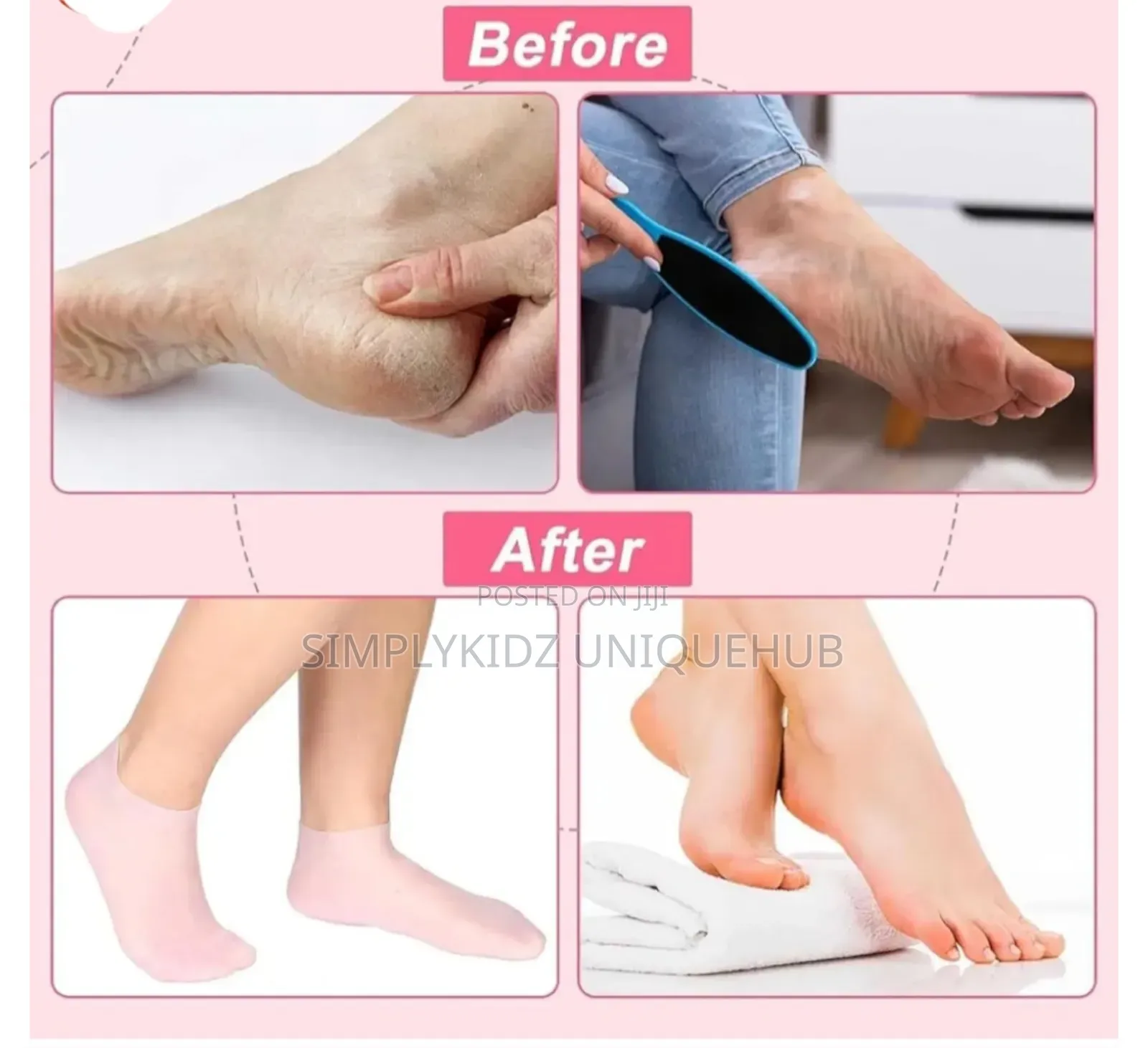 Silicone Moisturizing Socks - Pink