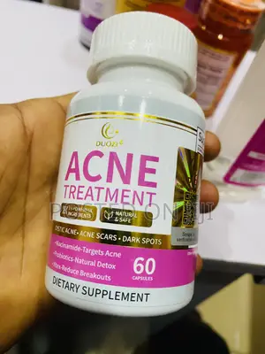 Douzi Acne Treatment for Stubborn Acne
