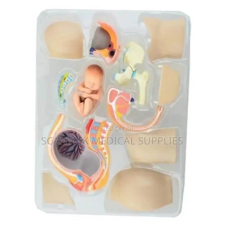 Human Uterus Dissection Model