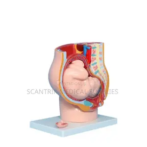Uterus With Ovaries Anatomical Model