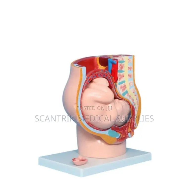 Uterus With Ovaries Anatomical Model
