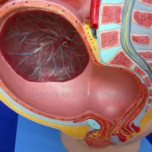 Uterus Dissection Training Model