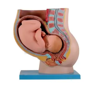 Uterus and Fallopian Tubes Section