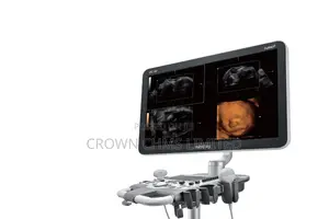 Mindray Dc-30 FHD – Clarity. Confidence. Convenience