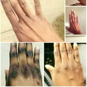 Photo - Pedicure / Manicure /Nail Polish