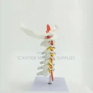 Cervical Spine With Carotid Arteries
