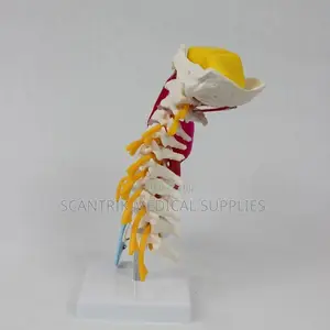 Neck Skeleton With Arterial Branches