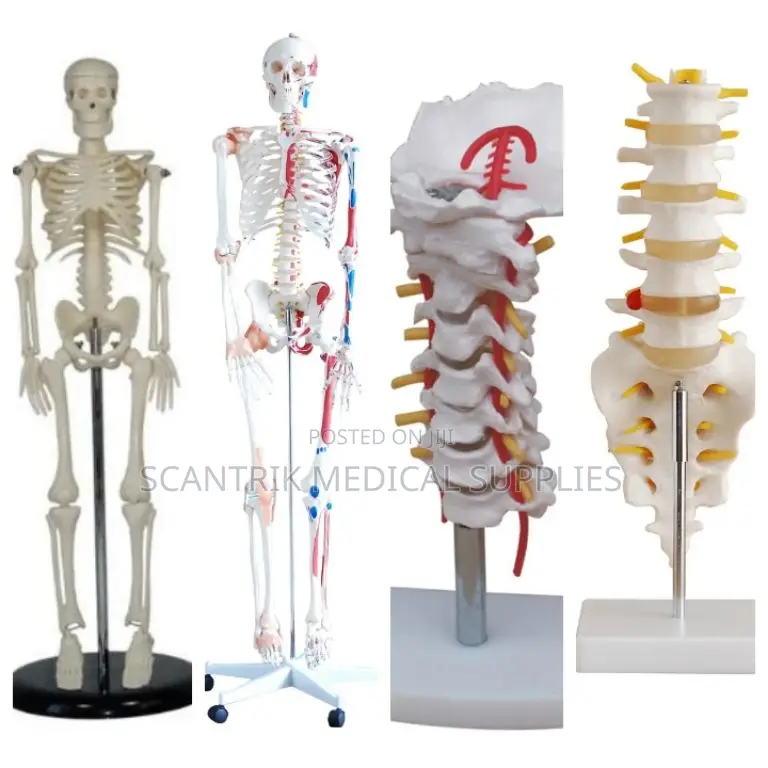 Cervical Framework With Carotid Vessels