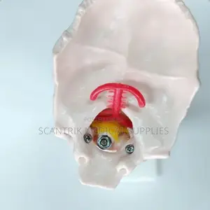 Cervical Backbone With Carotid and Vertebral Arteries