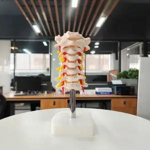 Cervical Bony Structure With Neck Vessels