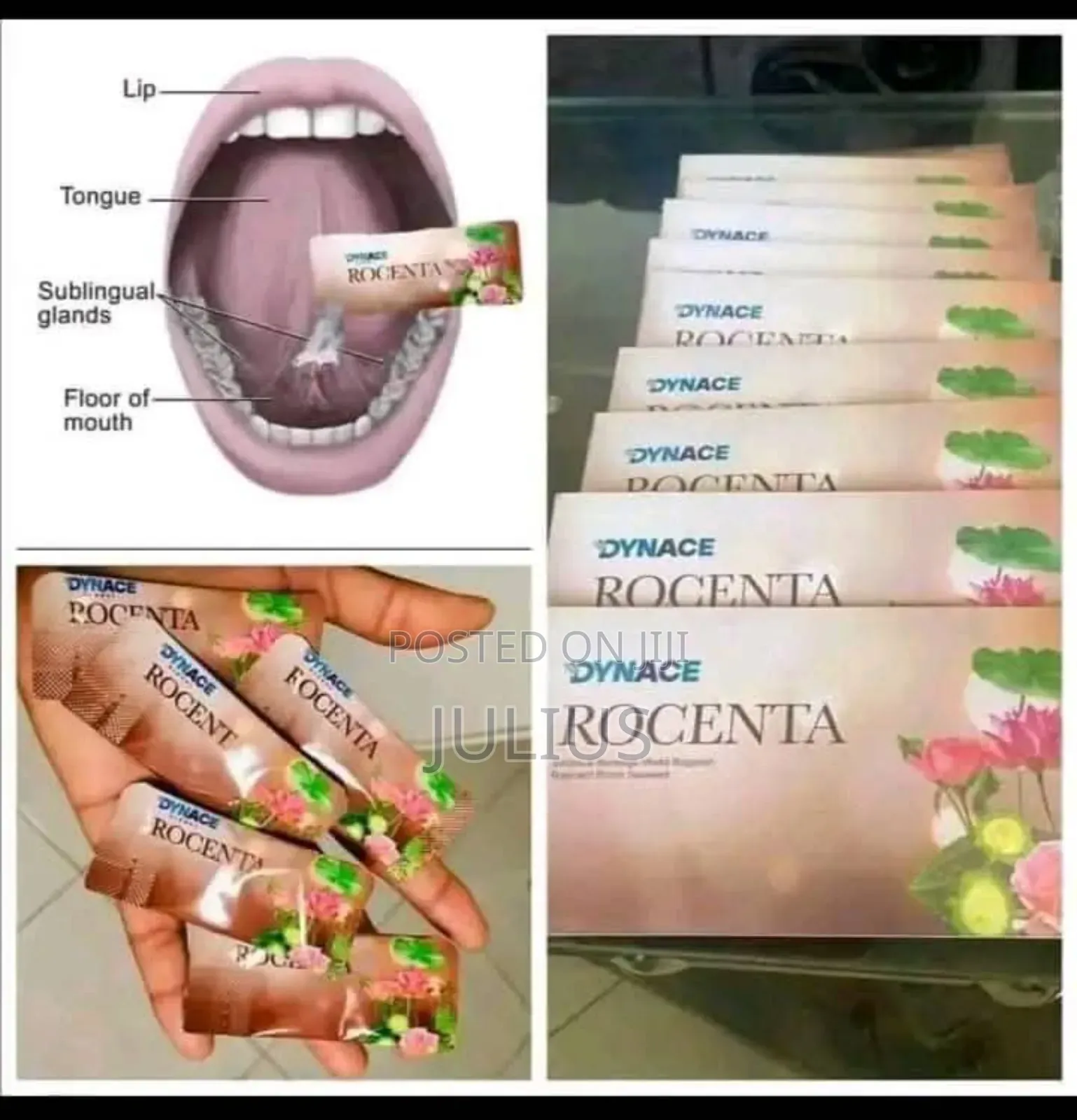 Dynace Rocenta