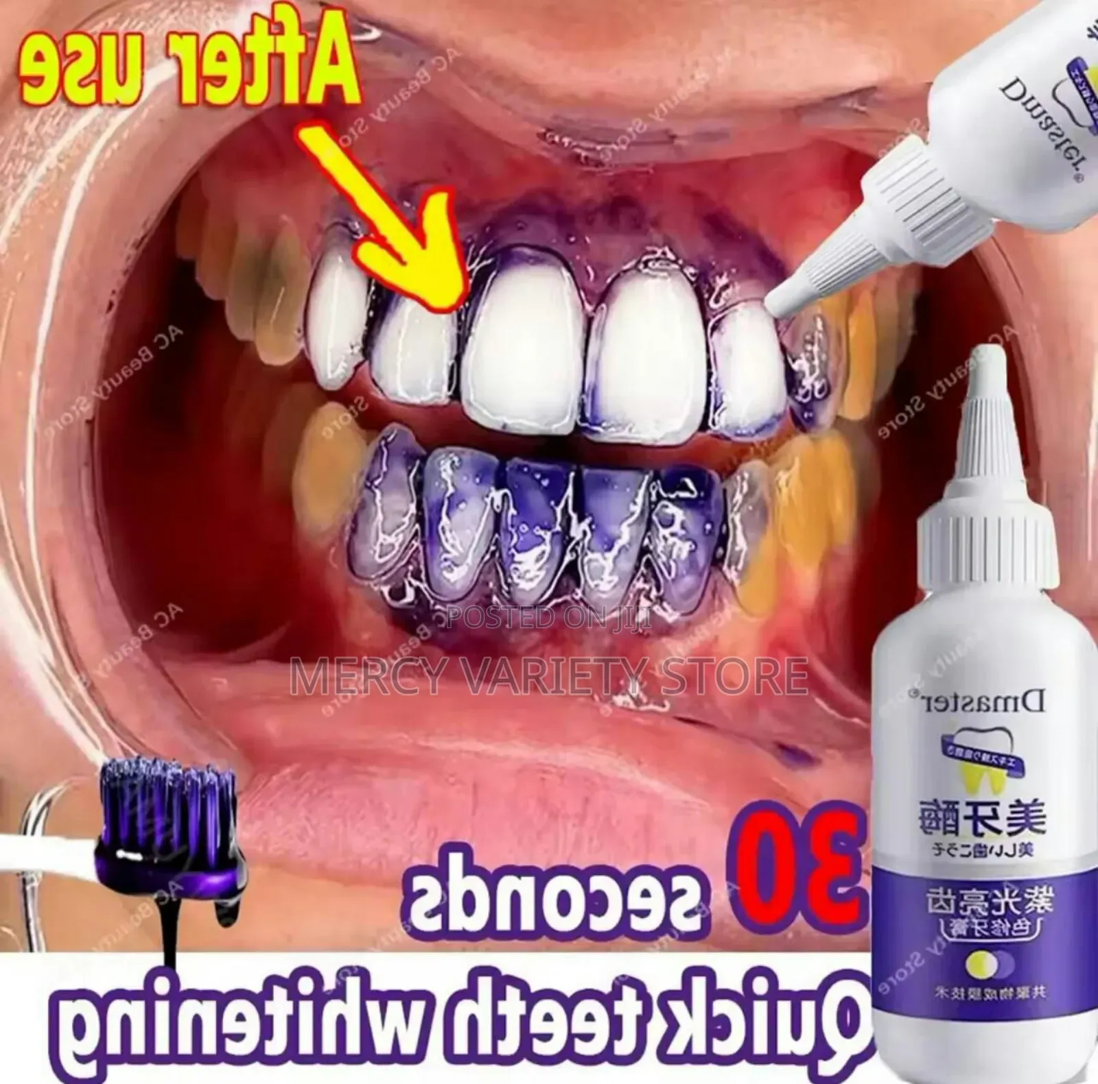 Effective Teeth Whitening