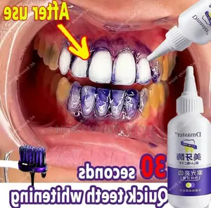 Effective Teeth Whitening