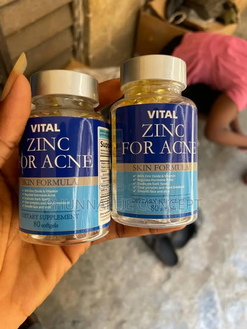 Zinc for Acne