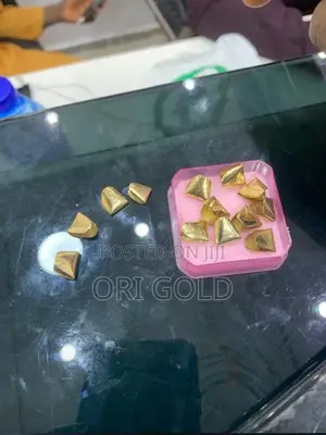 Photo - Gold Teeth Grill