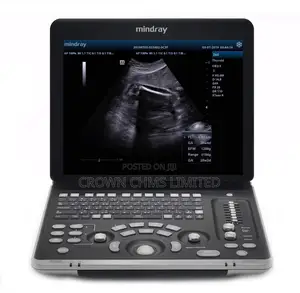 Mindray Z60mindray Z60 Ultrasound System
