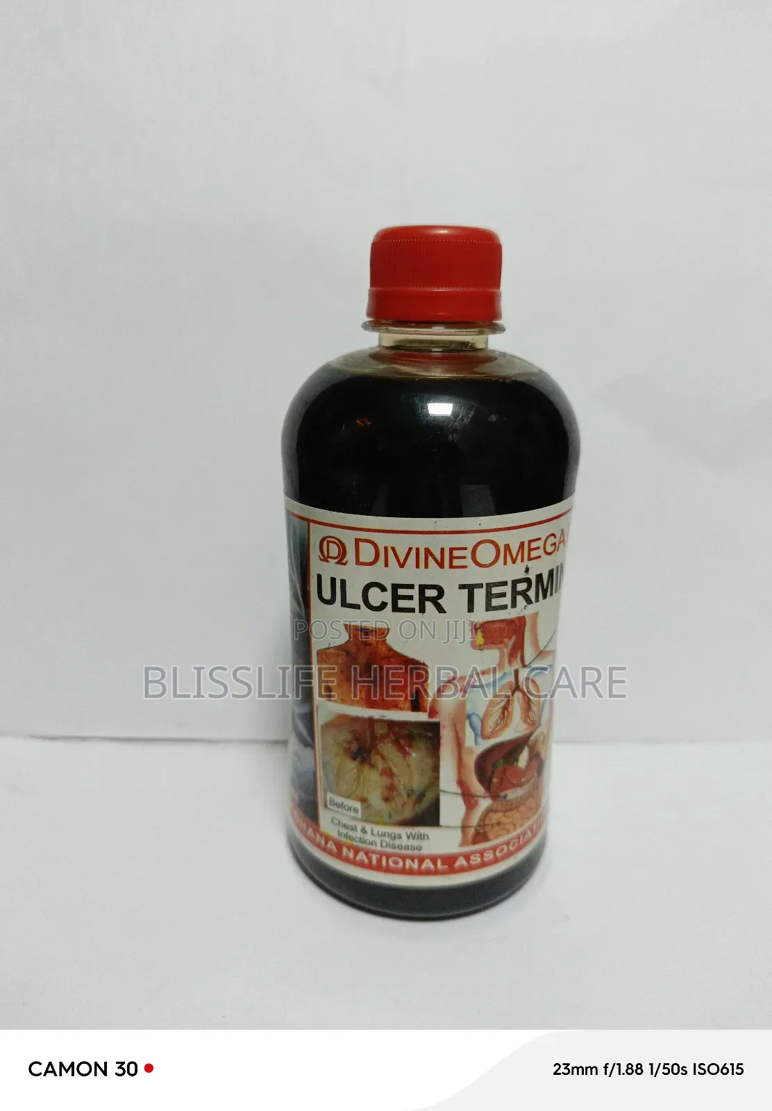 Ulcer Solution Ghanacin