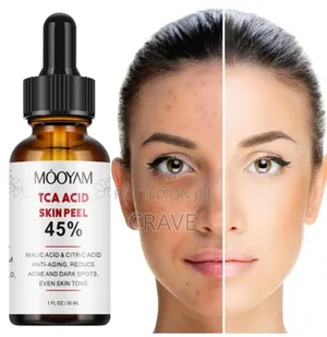 Mooyam Tca Acid Skin 50 Peel