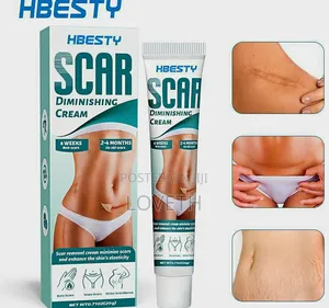 Photo - Hbesty Scar Stretch Mark Removal Cream