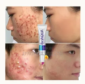 Bioaqua (Cream, Serum and Cleanser)