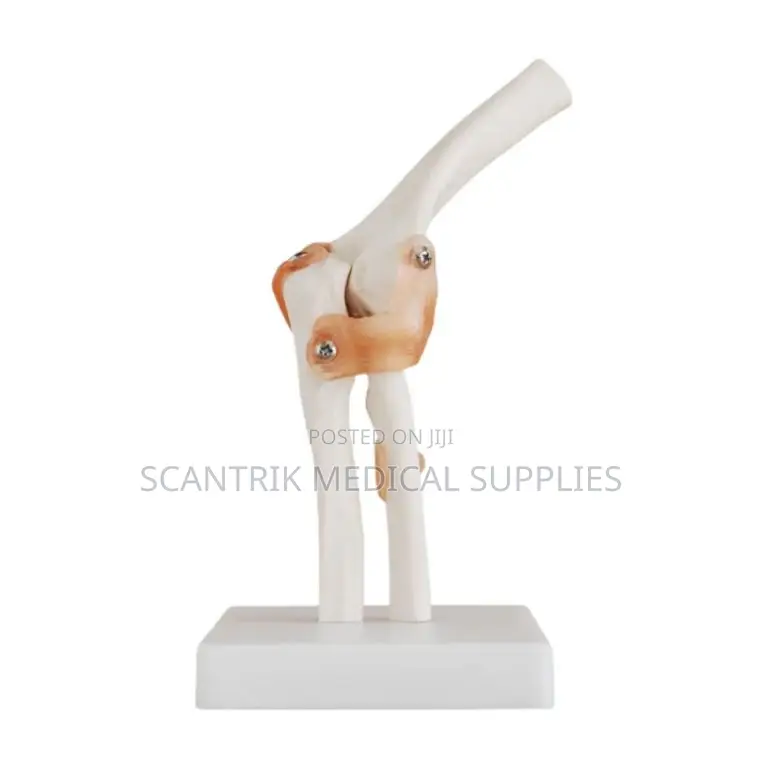 Educational Elbow Joint With Ligament Replica