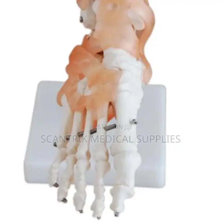 Surgical Planning Elbow Ligament Model