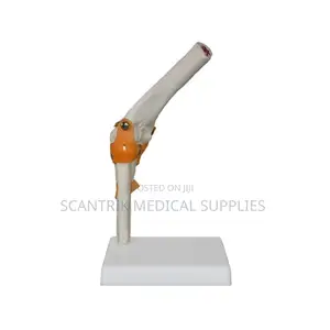 Human Elbow Ligament Educational Display